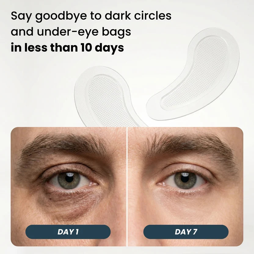 Microneedle Patches