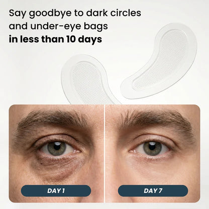 Microneedle Patches